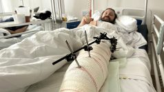 Pan Karel z České Lípy se zranil při jízdě na elektrokoloběžce